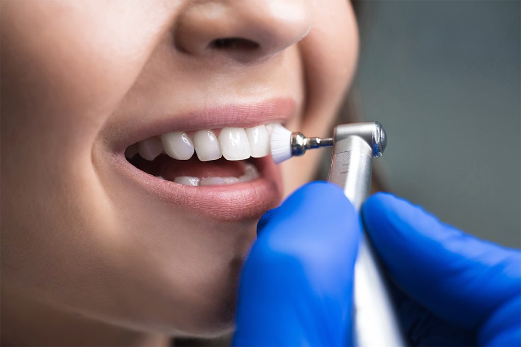 Preventive Dentistry: The Smartest Investment You Can Make for Your Smile